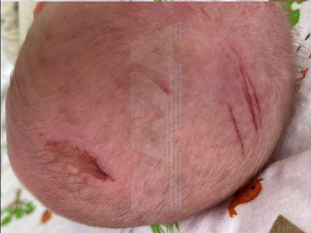 Мамы рассказывают: Жуткие истории из роддома, где погибло уже 9 новорождённых