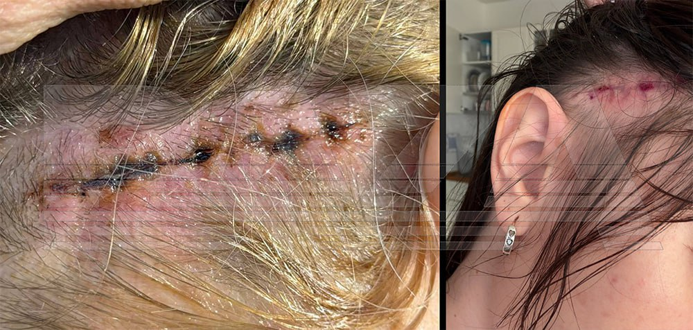 пластическая хирургия Китай