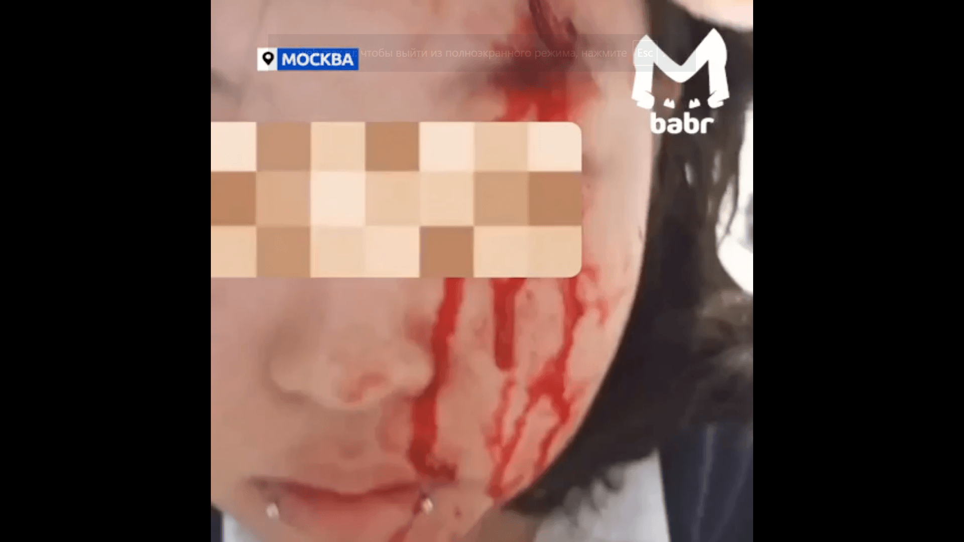избили девочку 